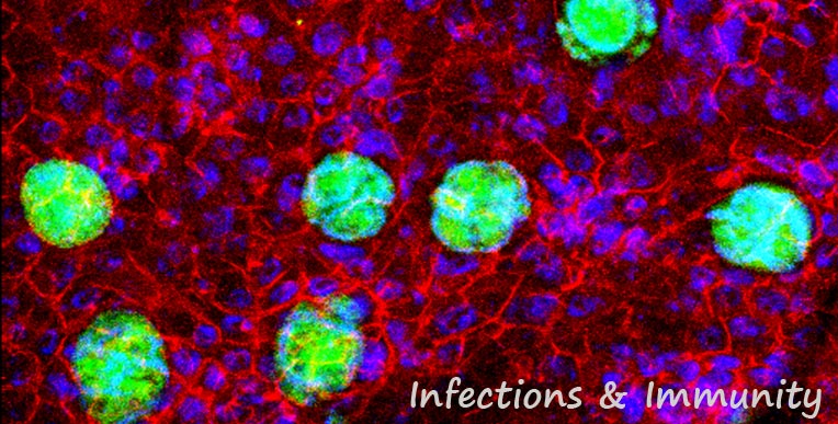 InfectionsImmunity