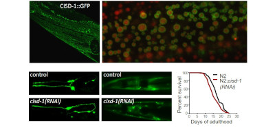 ΙΜΒΒ scientists uncovered the molecular mechanisms involved in the pathogenesis of the neurodegenerative disorder Wolfram Syndrome