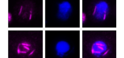 Revealing the structure and function of a cytoskeletal actin in malaria parasites