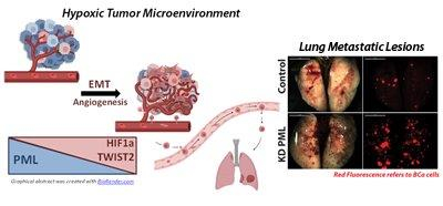Unlocking the Potential of PML: A Defender Against Breast Cancer Metastasis
