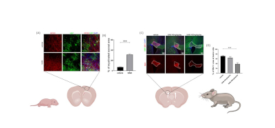 Caloric restriction mimetic enhances remyelination by promoting a less inflammatory environment